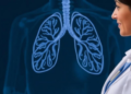 Focus groups identify lung cancer care feedback priorities