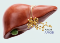 AAV3B antibodies affect eligibility for liver-targeted gene therapy