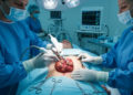Research report: Anatomy-preserving sequential management of vulvar Buschke–Löwenstein tumor using immunomodulation and ultrasonic ablation: A case report