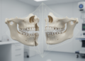 Automated virtual reduction of pseudo-fractured mandibles using sex-specific models