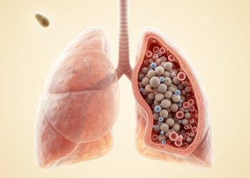 PCP, not bacterial co-infection, linked to pulmonary cryptococcosis mortality