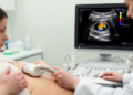 Combined Ultrasound Improves Intraductal Breast Lesion Diagnosis