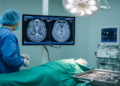 CT co-registration yields more stable D90 verification in 30-patient retrospective lung cancer study