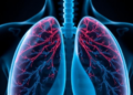 Common Sugar Molecule Uridine Shows Promise Against Deadly Lung Scarring