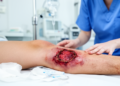 Case report links uncertain initial injury with later multidrug-resistant wound colonization in a 20-year-old man
