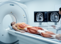 CT body-composition changes precede pancreatic cancer diagnosis