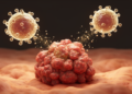 Retrospective cohort links immune checkpoint inhibitor–containing chemoimmunotherapy to longer overall survival in recurrent nasopharyngeal carcinoma