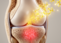 Quercetin improves bone measures in rats with collagen-induced arthritis alongside reduced Wnt3A and β-catenin expression