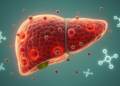 Serum CXCL-10 and CTLA-4 associated with inflammation in small treatment-naive chronic hepatitis B cohort