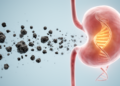 Long-term air pollution exposure linked with bladder cancer risk in prospective UK Biobank analysis