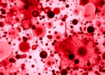 Amino Acid Fingerprint in Blood Reveals Who Escapes Fatty Liver Disease