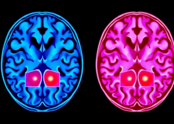 AI Reads Brain Scans Two Ways at Once to Gauge Neurological Disease Severity