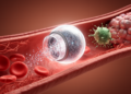 Smart nanoplatforms aim to make sepsis therapy responsive to disease stage