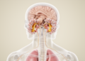 Case report links lung cancer leptomeningeal metastasis to bilateral vestibulopathy