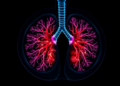 Iodine Density CT Offers First Real Glimpse of Lung Ablation Success