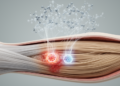 Bioinformatics study links two downregulated genes to tendinopathy biomarkers