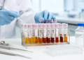 Plasma metabolite shows similar performance to CA19-9 in 60-person pancreatic cancer study