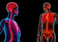Sex Shapes the Course of Myotonic Dystrophy, Landmark Registry Study Reveals