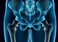 Uric Acid–HDL Ratio Shows Exploratory Mortality Pattern After Hip Fracture