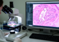 Deep learning predicts DNA repair deficiency in HGSOC pathology slides