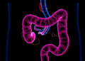 Preclinical study finds PTPN12 restrains colorectal cancer immunity