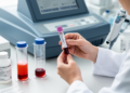 Blood urea nitrogen-to-albumin ratio predicts outcomes in cerebral venous sinus thrombosis