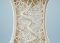Case report identifies likely pathogenic COL1A1 variant in pediatric bone fragility