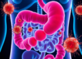 Blastocystis-positive IBS patients show higher IL-8 levels