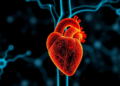 Lipoprotein(a) linked to aortic stenosis onset, but targeted therapy unproven