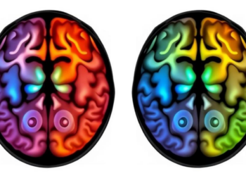 Anisotropic conductivity modeling for tDCS in Parkinson’s disease using multidimensional diffusion MRI