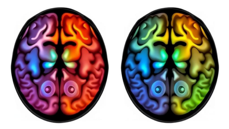 Anisotropic conductivity modeling for tDCS in Parkinson’s disease using multidimensional diffusion MRI