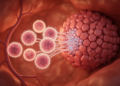 TCR-engineered T cells advance toward harder liver cancer targets