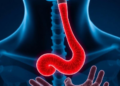 Scientists Uncover a Fat-Metabolism Switch That Fuels Esophageal Cancer and Blunts Chemotherapy