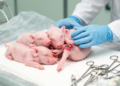 Four-neonate study links early osteotomy to favorable renal and orthopedic trends