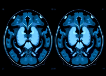 AI Reads Ultrasound to Sort Parotid Tumors With Striking Accuracy