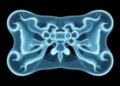 AI Models Predict Bone Scan Outcomes Before Imaging, but Time May Erode Their Accuracy