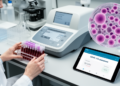 Trx1-CA125 strategy matches ROMA with higher ovarian cancer sensitivity