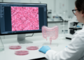 Simulation links Shigella trial design to underestimated vaccine efficacy