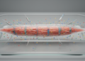 Single-fibre multi-omics links inflammation to altered myosin energetics in ICU weakness