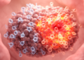 Immune and proliferative programs distinguish anti-PD-1-responsive endometrial cancer