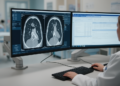 Prediction of respiratory failure in severe pediatric pneumonia via CT and electronic medical records fusion