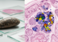 Research report: Spatial lipidomics of Fasciola hepatica using high-resolution AP-SMALDI Orbitrap MSI – a lipid tissue atlas