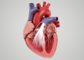 Severe aortic regurgitation: stable ventricular size, persistent risk