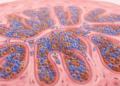 Early-onset colorectal cancer shows distinct immune-cell spatial patterns