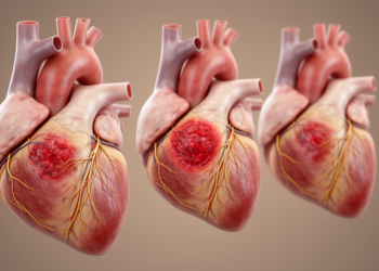 Ventricular injury timelines may not fit the heart’s conduction system
