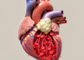Review links coronary microvascular dysfunction to upstream plaque formation