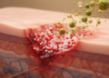 Engineered Herbal Therapies Target Persistent Inflammation in Diabetic Wounds