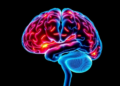 Brain Waste-Clearance System Scans Could Predict Epilepsy Surgery Success