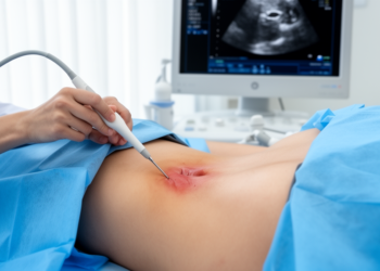 Ultrasound-guided sacroiliac puncture links stronger improvement with inflammatory disease