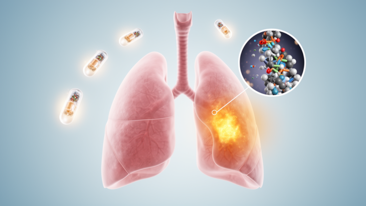 Pneumonia emerges as the most reproducible respiratory warning sign across four BTK inhibitors